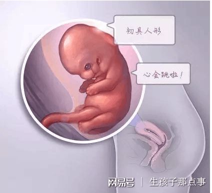 反复流产